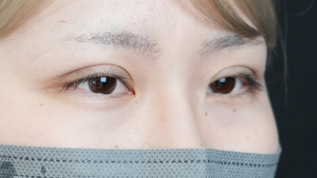 Postoperative Condition Part 1