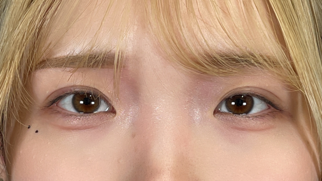 Postoperative Condition Part 1