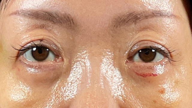 Postoperative Condition Part 1