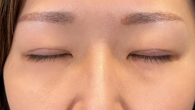 Postoperative Condition Part 1