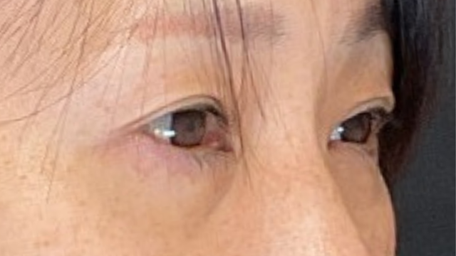 Postoperative Condition Part 1