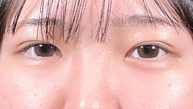 Postoperative Condition Part 1