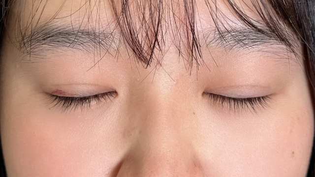 Postoperative Condition Part 1