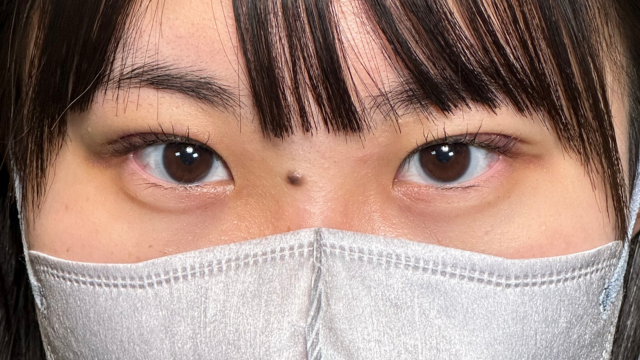 手术前的状态 其一