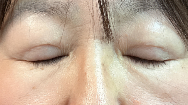 Postoperative Condition Part 1