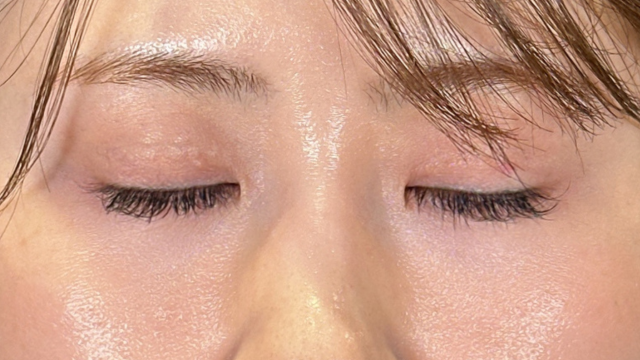 Postoperative Condition Part 1