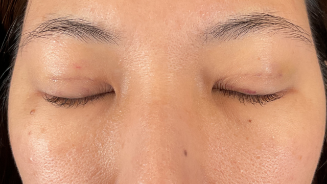 Postoperative Condition Part 1