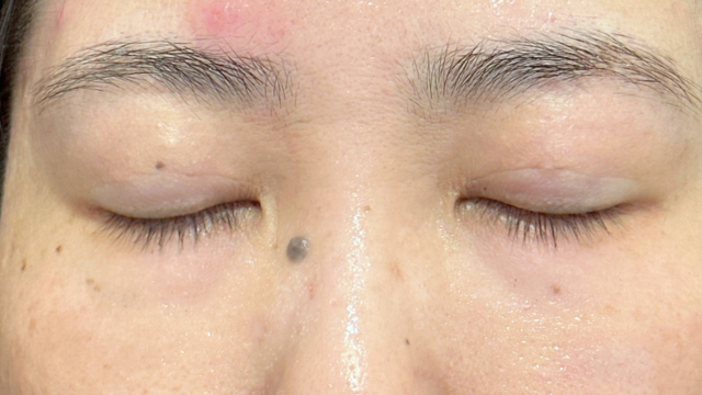 Postoperative Condition Part 1