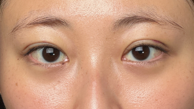 Postoperative Condition Part 1