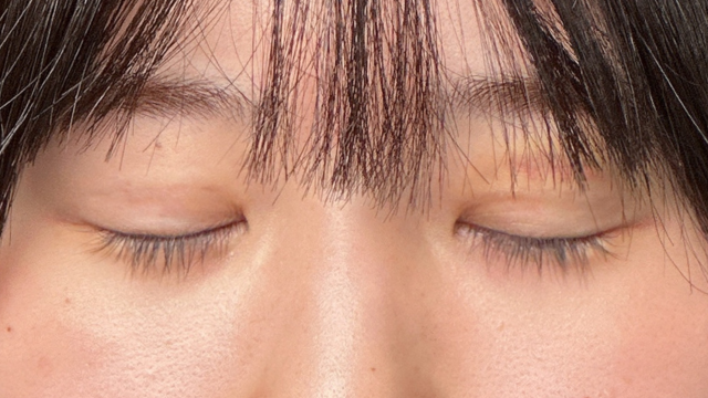 Postoperative Condition Part 1