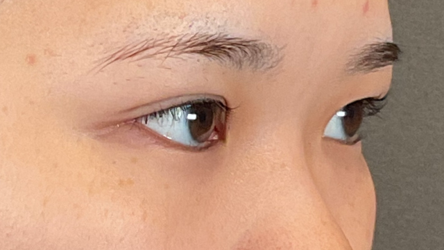 Postoperative Condition Part 1