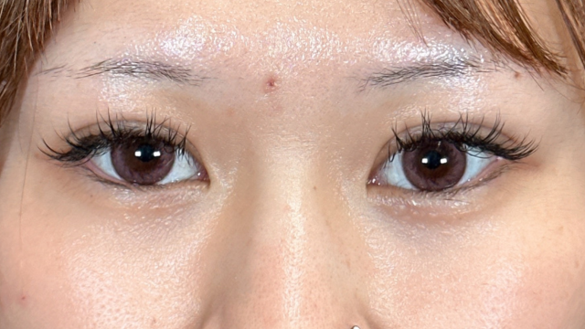 Postoperative Condition Part 1