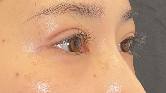 Postoperative Condition Part 1