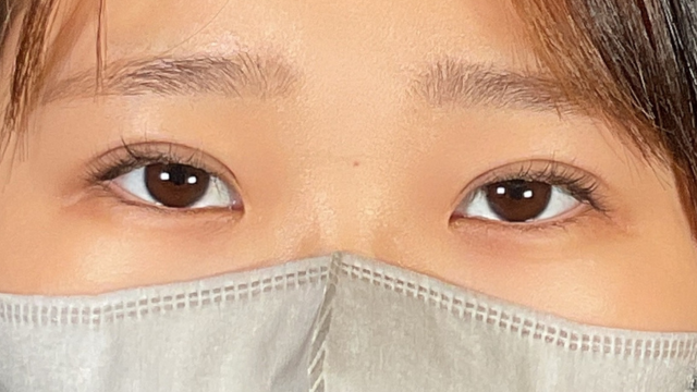 Postoperative Condition Part 1