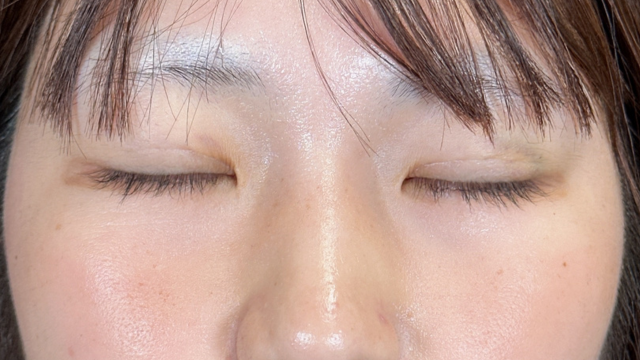 Postoperative Condition Part 1