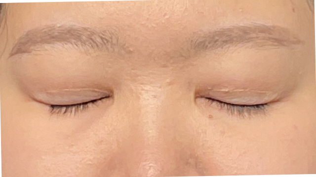 Postoperative Condition Part 1