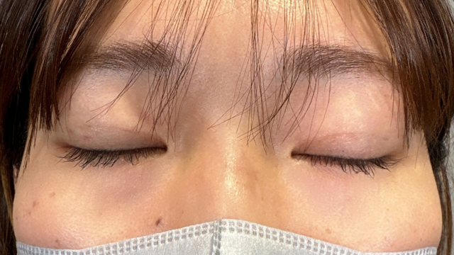 Postoperative Condition Part 1