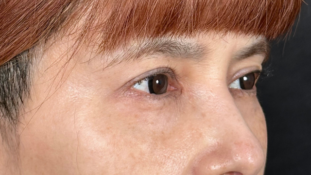 Postoperative Condition Part 1