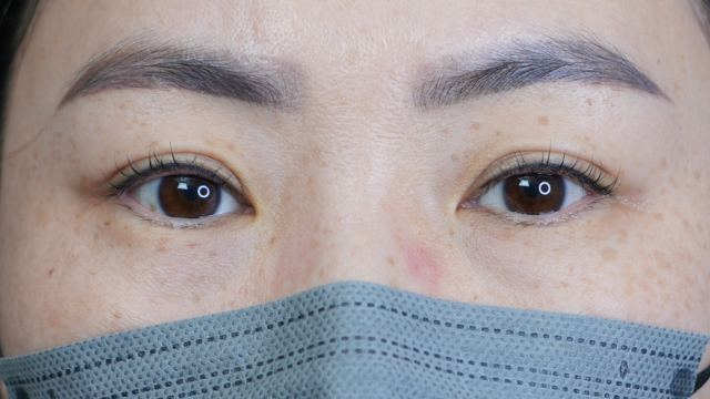 Postoperative Condition Part 1