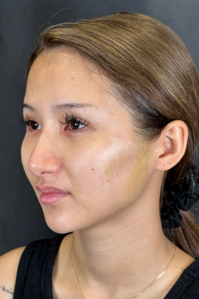 Postoperative Condition Part 1