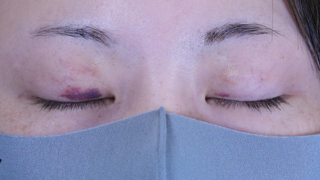 Postoperative Condition Part 1