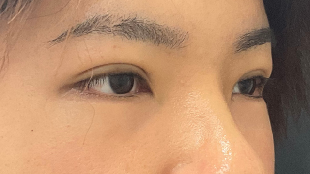 Postoperative Condition Part 1