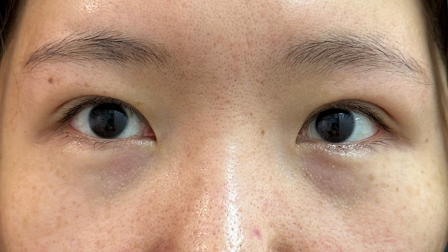 Postoperative Condition Part 1