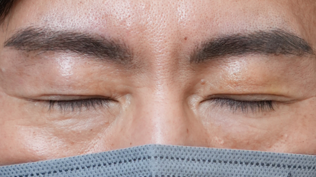 Postoperative Condition Part 1