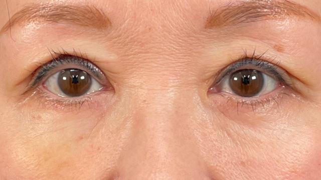 Postoperative Condition Part 1