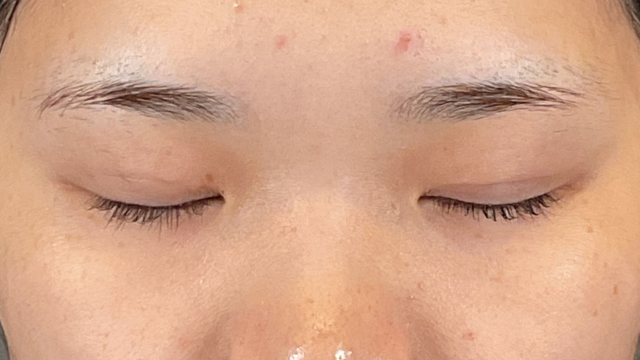 Postoperative Condition Part 1