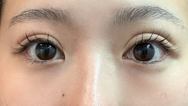 Postoperative Condition Part 1