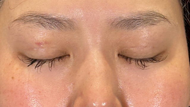 Postoperative Condition Part 1