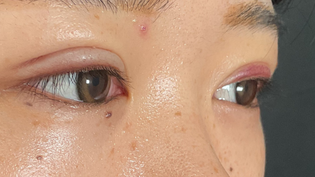 Postoperative Condition Part 1