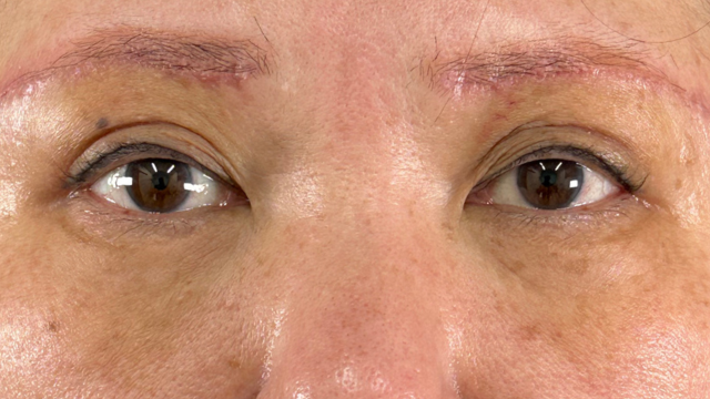 Postoperative Condition Part 1