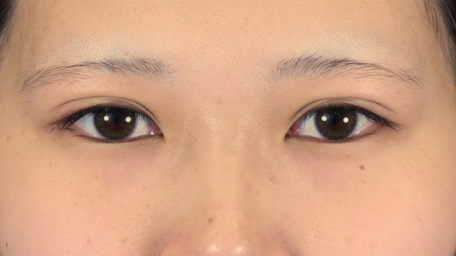 Postoperative Condition Part 1