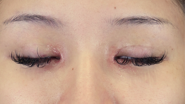 Postoperative Condition Part 1