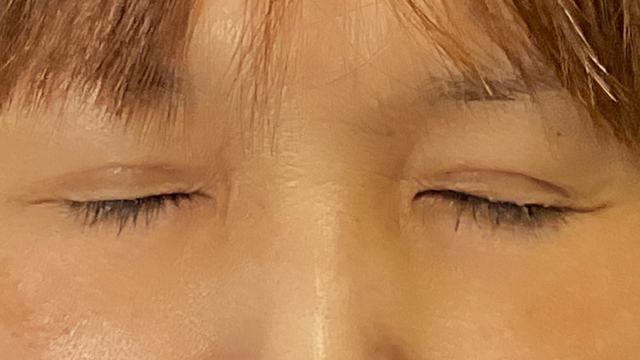 Postoperative Condition Part 1