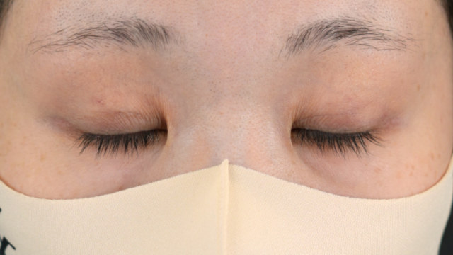 Postoperative Condition Part 1