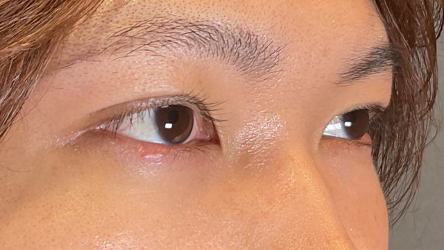 Postoperative Condition Part 1