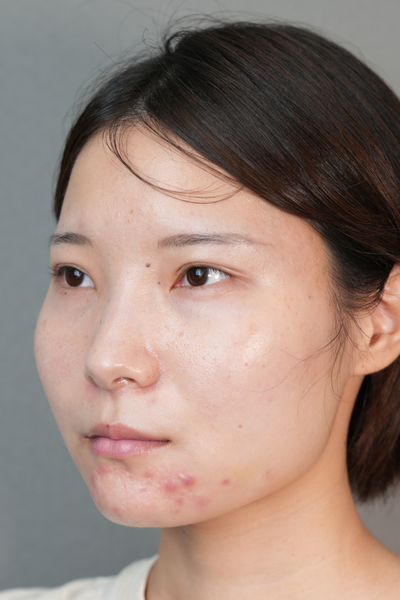 Postoperative Condition Part 1