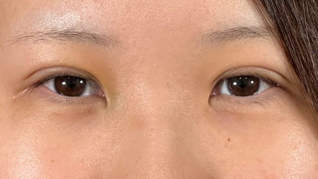 Postoperative Condition Part 1