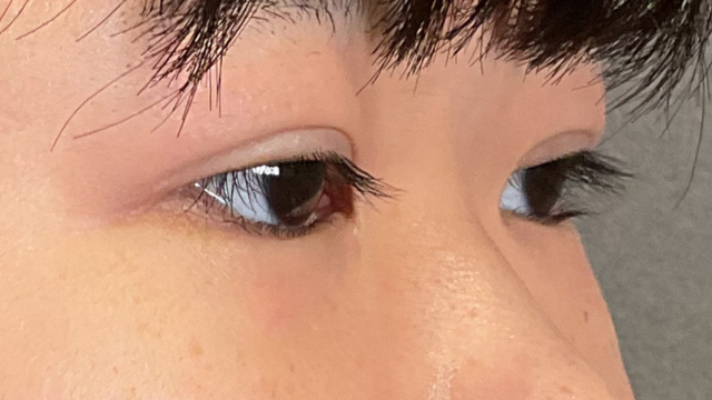 Postoperative Condition Part 1