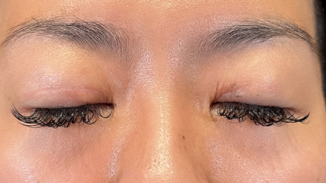 Postoperative Condition Part 1