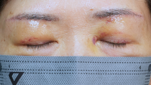 Postoperative Condition Part 1