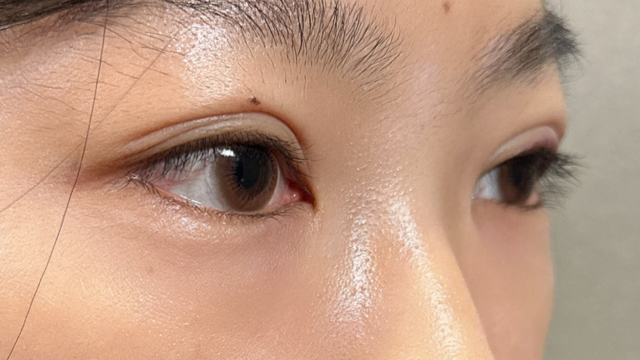 Postoperative Condition Part 1