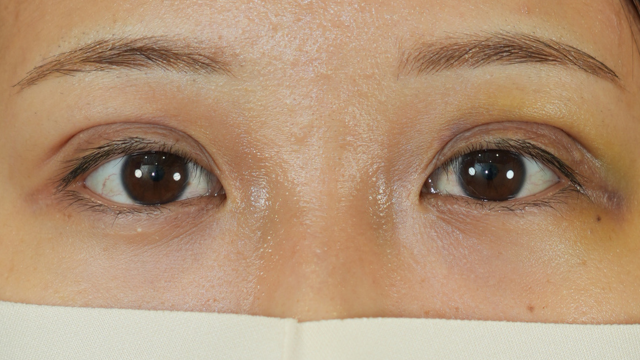 Postoperative Condition Part 1