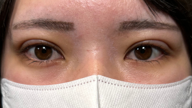 Postoperative Condition Part 1