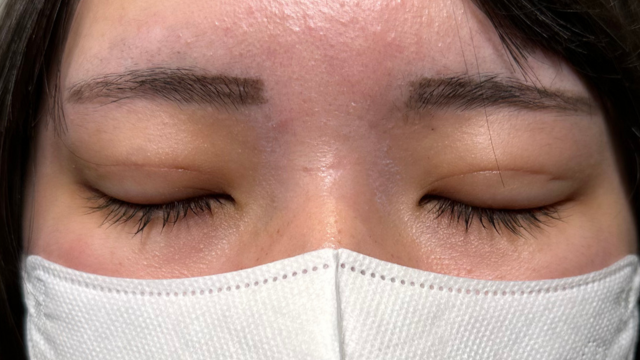 Postoperative Condition Part 1