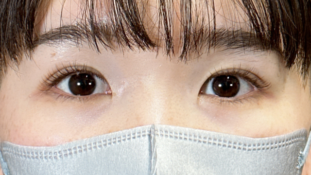 Postoperative Condition Part 1