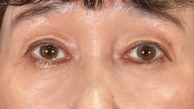 Postoperative Condition Part 1